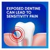 Sensodyne Daily Care Toothpaste 100g