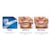 Oral B 3D White Luxe Whitening Treatments Advanced Seal 14 Pack