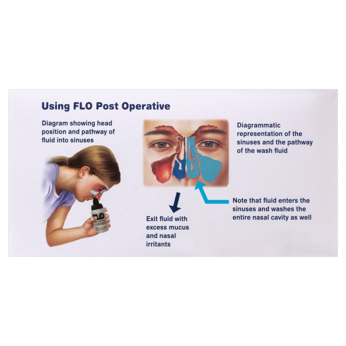 Flo Post Operative Kit 70 Sachets