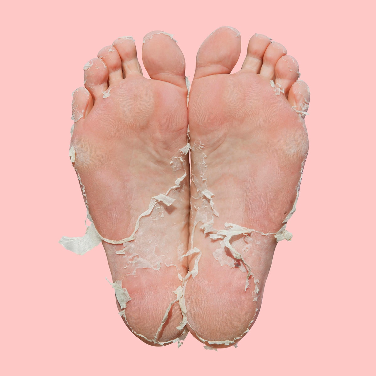 Skin Republic Foot Peel (2 Booties)